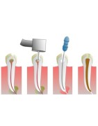 Materiały endodontyczne